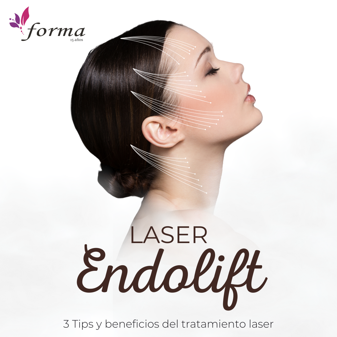 Endolifting facial y corporal para rejuvenecer la piel sin cirugía. Tratamiento con láser para firmeza y redefinición.